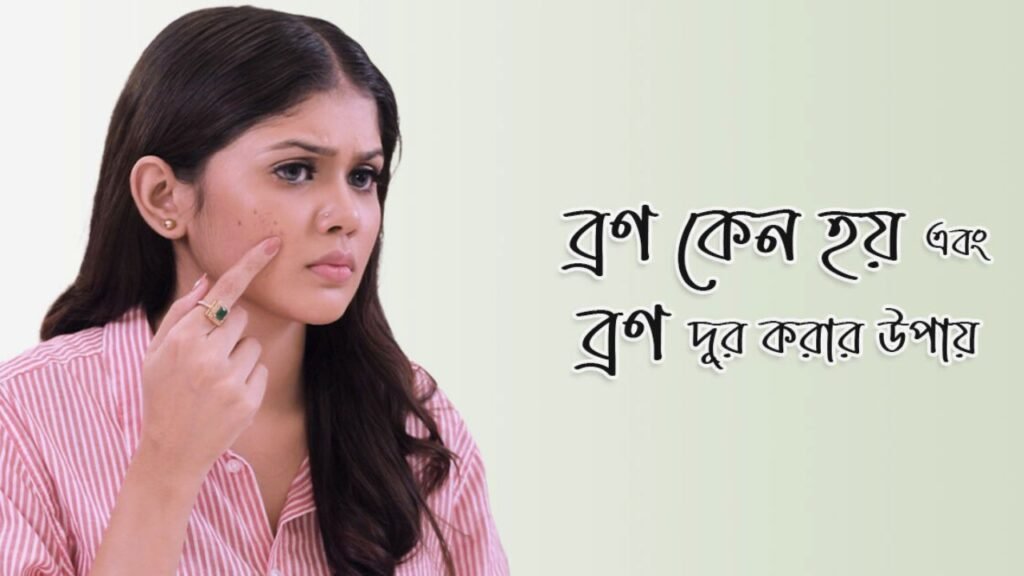 ব্রণ কেন হয় ব্রণের চিকিৎসা