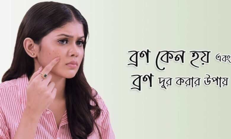 ব্রণ কেন হয় ব্রণের-চিকিৎসা