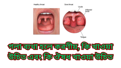 গলা ব্যথা হলে করণীয়, কি খাওয়া উচিত এবং কি ঔষধ খাওয়া উচিত