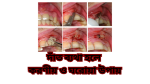 দাঁত ব্যথা হলে করণীয় ও ঘরোয়া উপায়