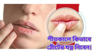 শীতকালে কিভাবে ঠোঁটের যত্ন নিবেন।